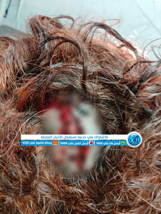 المحررة مع ضحية الاعتداء