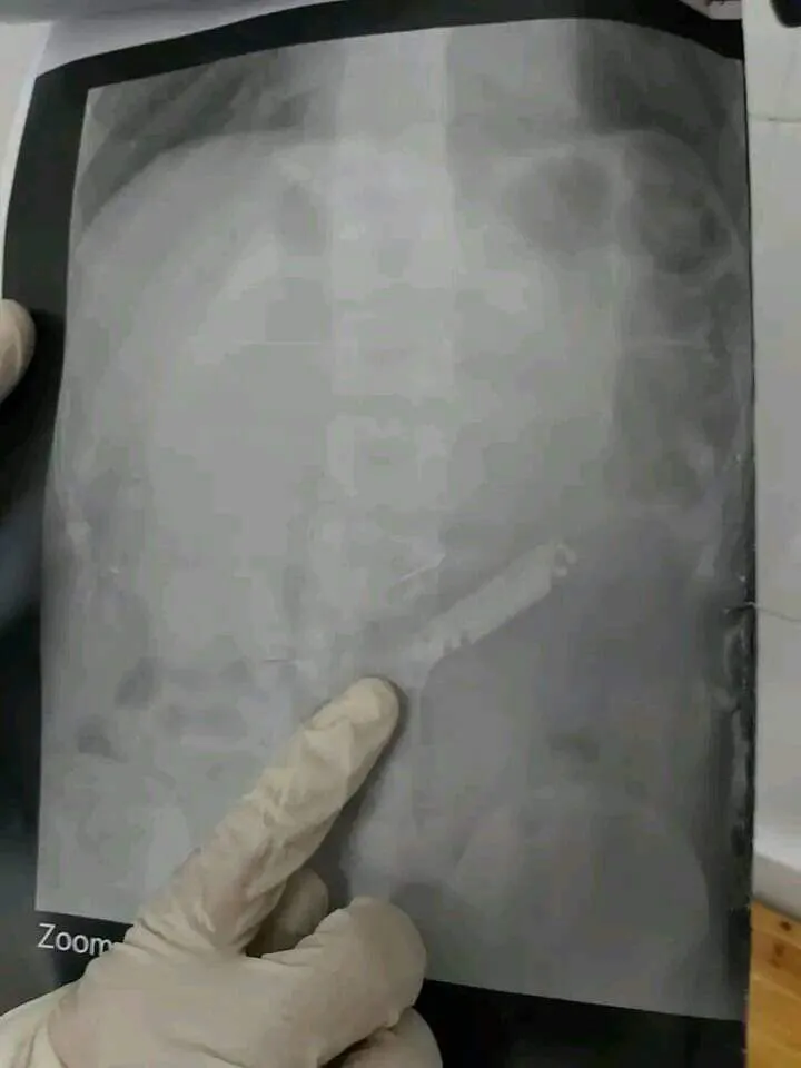 جانب من العملية