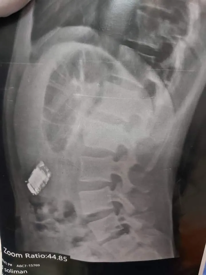 جانب من العملية