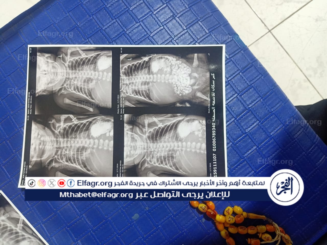 تفاصيل الطفل