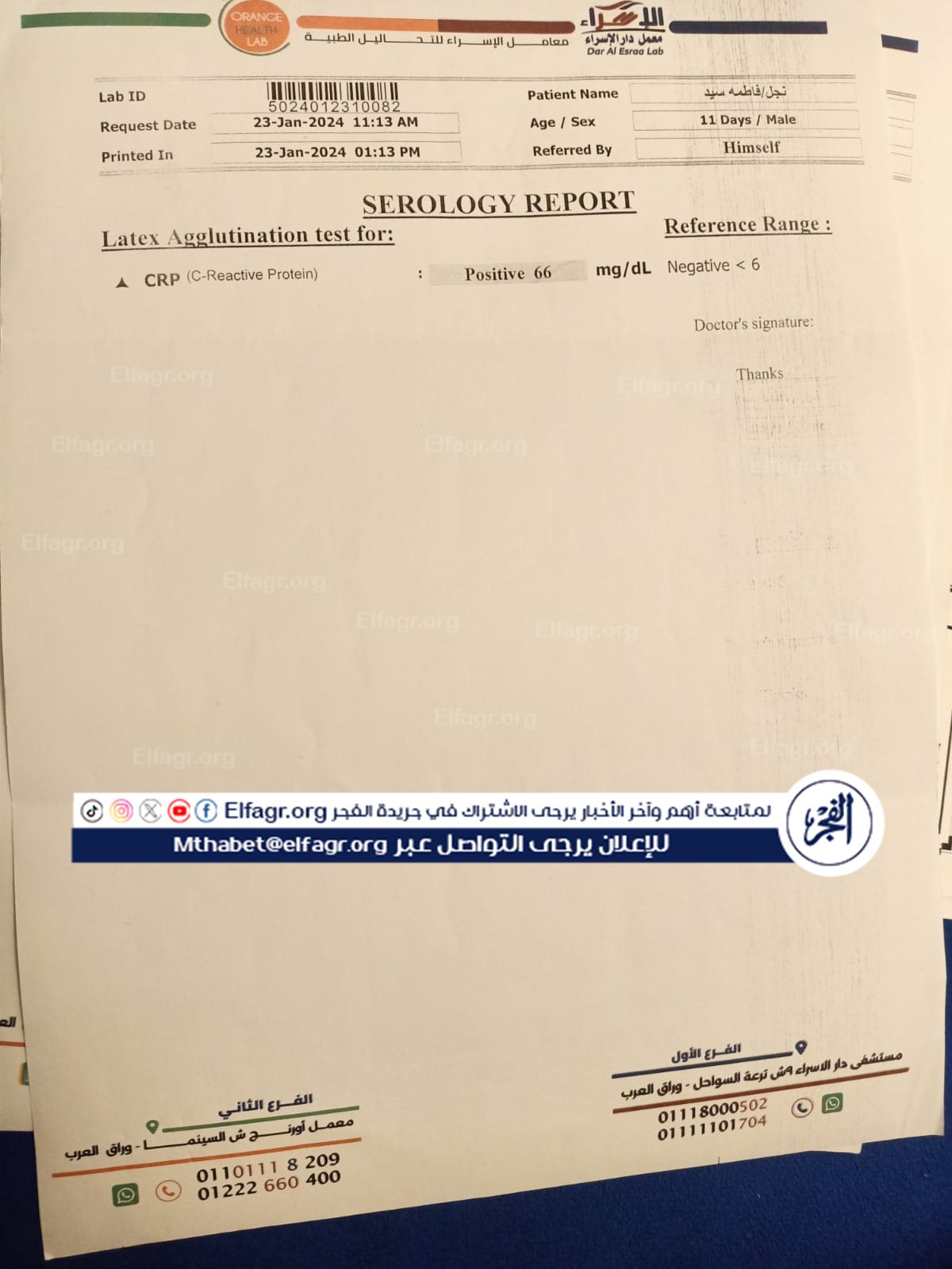 تفاصيل الطفل