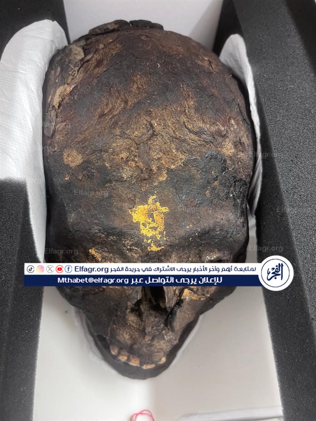 25ae2f52-e1be-45ac-9cb4-7c1a5ce3013d