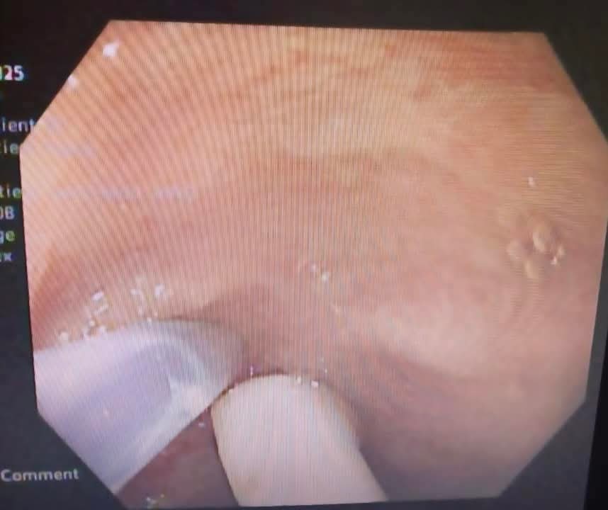 FB_IMG_1738160701790