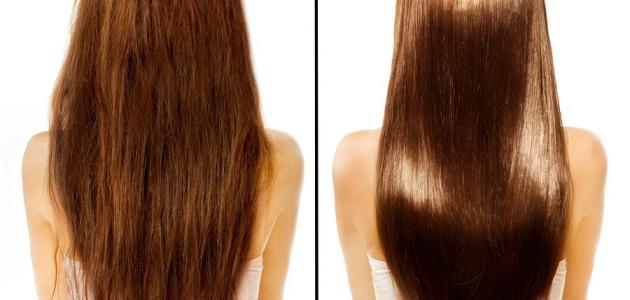 العناية بالشعر