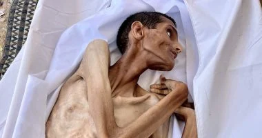 وفاة شاب فلسطيني جوعًا في مستشفى الشفاء.. صرخة إنسانية من غزة