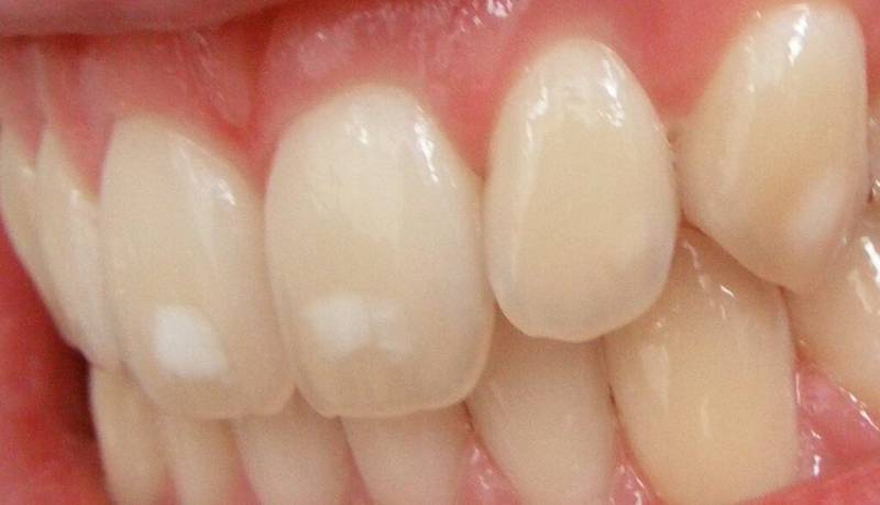 صحة الأسنان.. عنوان الجمال والوقاية من الأمراض