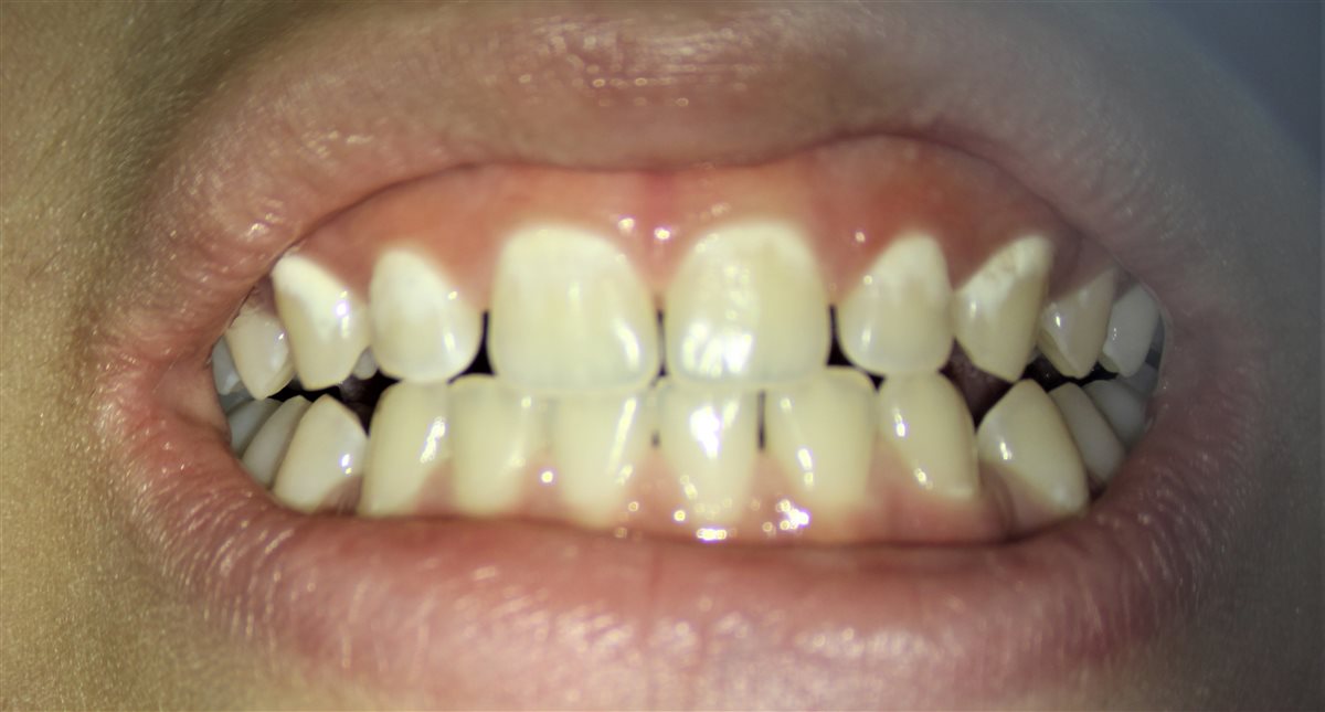 صحة الأسنان.. عنوان الجمال والوقاية من الأمراض