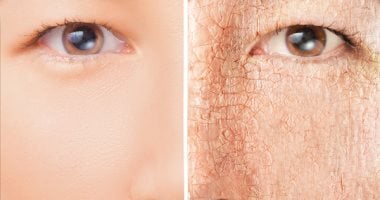 <strong>العناية بالبشرة في فصل الشتاء: خطوات بسيطة لبشرة ناعمة وخالية من الجفاف</strong>