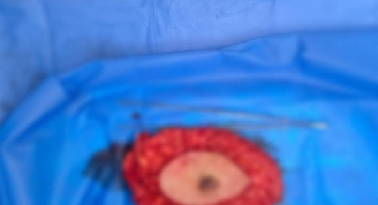 لقطة من العملية