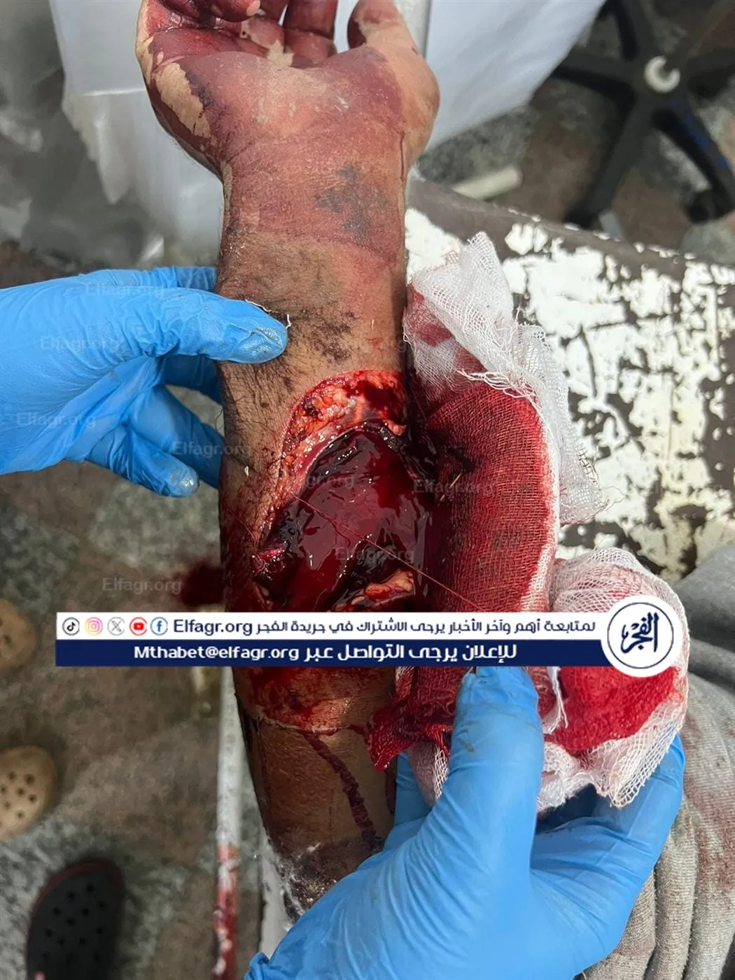 98c91490-0113-4d67-b396-b4bdc09c527b