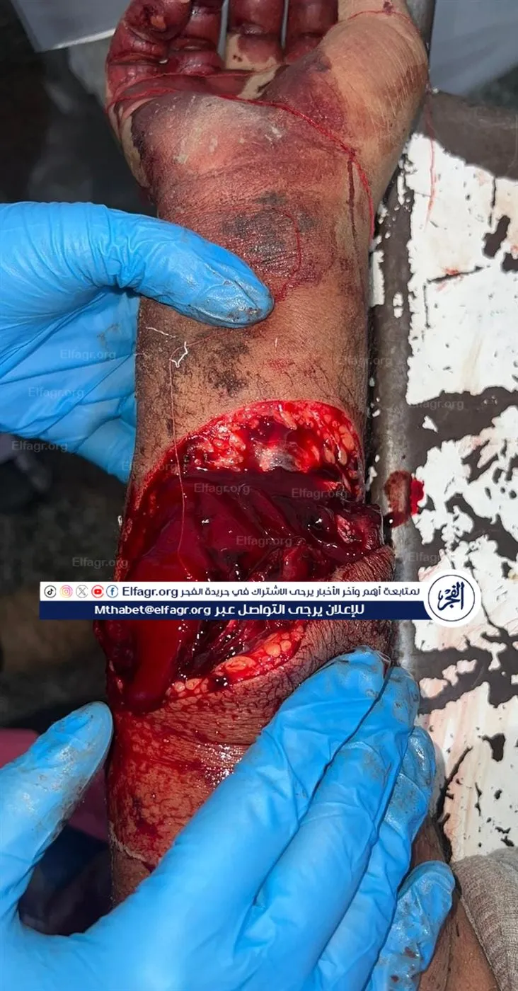 bfe03cfd-b8ec-49f7-ba19-5d6ce08ce68b