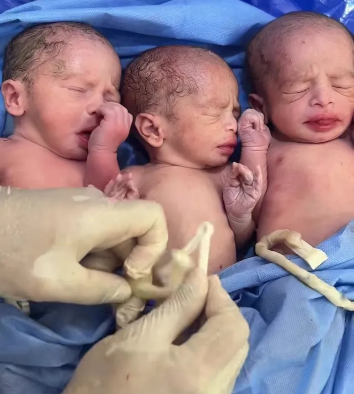 توائم متعددة داخل عيادات خصوبه بمصر