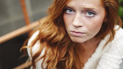 تعرف على أهم أسباب ظهور النمش وعلاجه