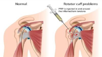 استشاري عظام: 