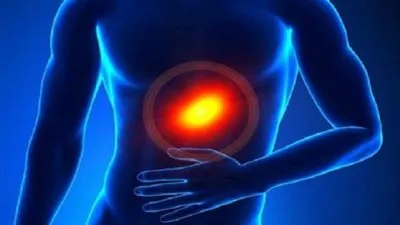  أسباب قرحة المعدة أعراضها وعلاجها