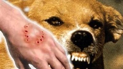 غضب بين أهالي كفرصقر لعقر كلب مسعور 4 أشخاص بالشرقية 