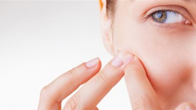 طرق الوقاية من حب الشباب 