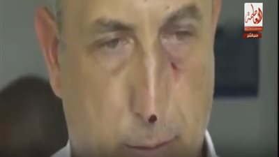 عزمي مجاهد عن تعذيب قادة الجيش التركي: 