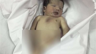 مواطن يتهم مستشفى رنية بالتسبب في وفاة مولوده