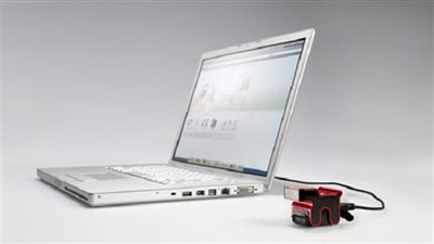 كمبيوتر ينجح في تشخيص مرض نادر