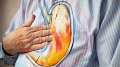 5 عادات خاطئة تؤدى إلى حموضة المعدة