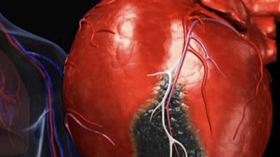 صحة قلبك مرتبطة بمهنتك