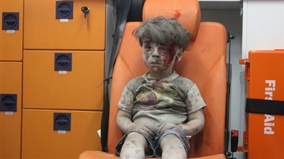 وفاة شقيق الطفل السوري 