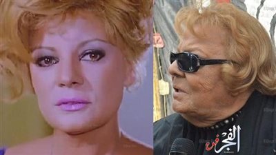 طبيب الفنانة نادية لطفي يوضح تفاصيل حالتها الصحية