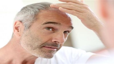 دراسة: زراعة الشعر تجعل الرجال أكثر جاذبية وأصغر سنا