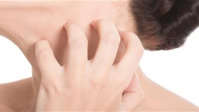 الحساسية الكاذبة.. الأسباب وطرق العلاج 