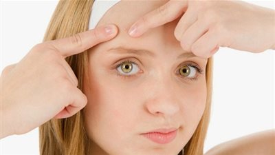 وصفات منزلية تخلصك من البثور والرؤوس البيضاء