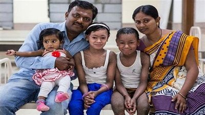  حالة مروعة .. طفلان بجلد أفعي تنسلخ كل 10 أيام  (صور)