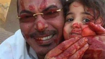 تعرف على صاحب الصورة التي صدمت رواد مواقع التواصل في مصر