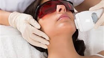 4 إجراءات هامة قبل الخضوع  لجلسات Laser Hair Reduction
