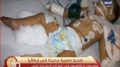 حبة فول سوداني تتسبب في اختناق طفل (فيديو)