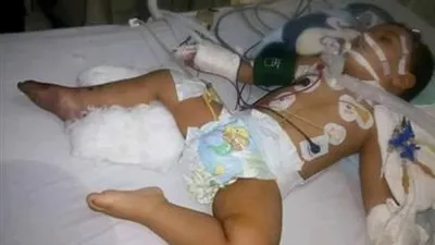  أهالي طفل الإسماعيلية المصاب: وزير الدفاع قرر نقله إلى مستشفى الجلاء العسكري 