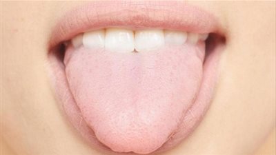 6 علامات باللسان تدل على الصحة العامة للجسم