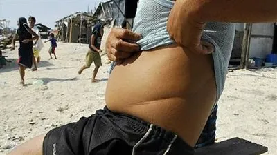 منظمة إنسانية: أمريكا وإسرائيل وراء مافيا استئصال الأعضاء البشرية