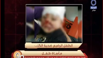 معتز عبد الفتاح يعرض مأساة رضيع عضه كلب مسعور (فيديو)