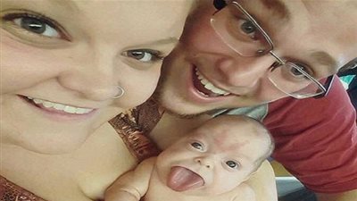 ولادة طفل بلسان أكبر من فمه واستئصال 15 سنتيمترا لإنقاذ حياته (صور)