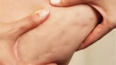 وصفة بسيطة تقضي على 