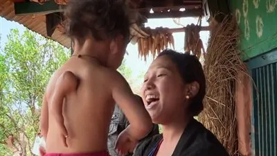 مأساة طفل نيبالي يعيش بثلاث أذرع (صور)