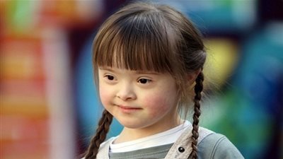 العلامات الشخصية والجسدية للطفل المصاب بـ