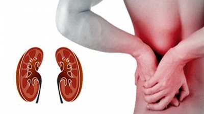 8 عادات سيئة تؤدي للفشل الكلوي.. تجنبيها