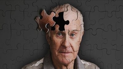 دراسة: المنشطات الجنسية تقلل مخاطر الإصابة الزهايمر