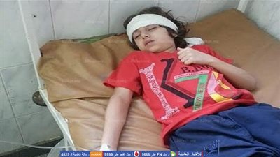 عقب تعرضه للضرب المبرح.. إصابة طالب بـ