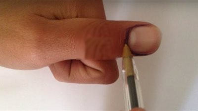 طريقة جديدة لعلاج آلام الأسنان  (صور)