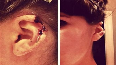 رجل يتسبب في عاهة مستديمة لحبيبته بـ