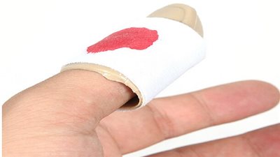 نصائِح صحيَّة هامة حول التعامل الصحيح مع الجروح النازفة!