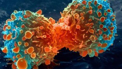 تقرير طبى: سرطان الشرج والفم والبروستاتا تنتقل عن طريق الاتصال الجنسى